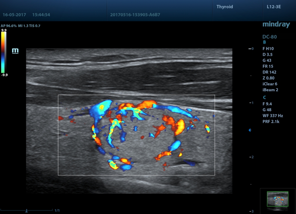 Mindray DC-80 X-Insight