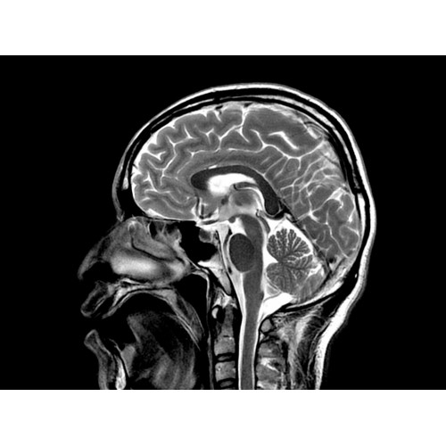 МРТ аппарат GE Optima MR450w 1.5T