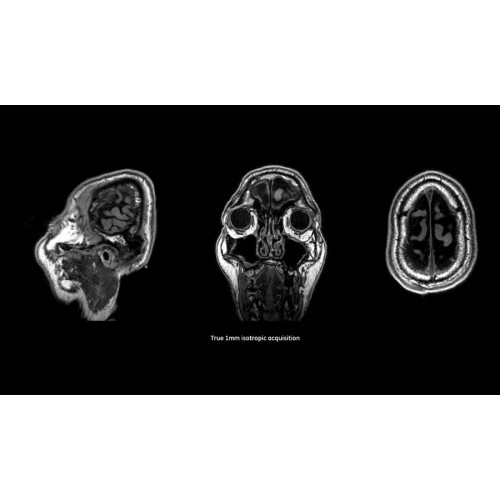 МРТ аппарат GE SIGNA Voyager 1.5T